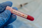 Ebola outbreak: Health minister directs ICMR, National Centre for Disease Control, for surveillance, testing