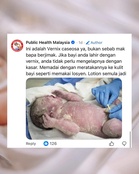 Lapisan putih pada bayi baru lahir? Ini penjelasannya