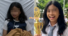 Kerana Keracunan MBG, Pelajar Cemerlang Indonesia ‘Lumpuh’ & Tak Kenal Ibu Sendiri