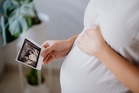 Malaysian law provides for exceptional pregnancy termination under Penal Code