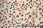 WHO: Risk of hantavirus spread remains low