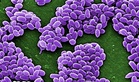 Indonesia steps up anthrax control measures in Yogyakarta after positive samples