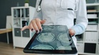 New AI‑Powered MRI May Help Find Alzheimer’s Before Symptoms Worsen at 92.9% Accuracy