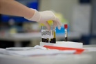 IBS May Be Linked to Blood Fats and Metabolism, Major Study Suggests