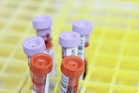 ACS Updates its Colorectal Cancer Screening Guidelines