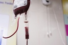 New Blood Thinner Might Slow Down Cognitive Decline in Alzheimer’s Patients With AFib
