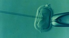‘You don’t think about it early’: Actress opens up on IVF, fertility journey