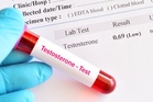 How male testosterone levels halved in 50 years