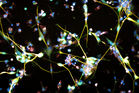 Brain cancer breakthrough as new study finds cell therapy could target deadly glioblastoma
