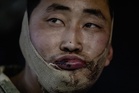 Why North Korea is at the heart of South Korea’s strange rift with Ukraine