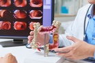 FDA approves another blood test for colon cancer screening