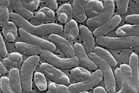 1 dead and 12 infected by ‘flesh-eating bacteria’ that invade waters and seafood along Florida’s coast