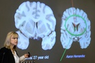 One in four NFL players could get CTE, alarming new study finds