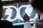 Doctors hail cancer injection that can destroy entire tumors