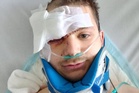 Man’s eye rebuilt after eight painstaking operations following car crash