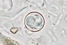 Mystery parasite that causes ‘explosive diarrhea’ spreads to 17 US states
