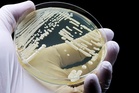 What to know about deadly ‘superbug’ fungus spreading across US