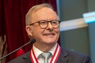 Australian PM apologies for ‘disrespectful’ Kylie Minogue comment