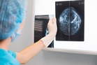 Florida woman was told her mammogram was clear. Now, she is getting $7M after her stage 4 breast cancer