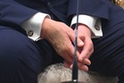 Trump’s makeup-covered bruised hand on full display as he meets with NATO leaders in Turkey