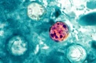 Parasite that causes ‘explosive diarrhea’ has infected over 1,000 in 17 states - here is how to stay safe