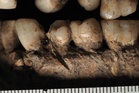 Man from 100,000 years ago may be earliest victim of stabbing in face