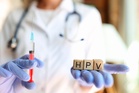 How do the HPV home-testing kits work and am I eligible?
