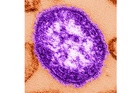 Pennsylvania officials report state's 3rd death involving measles