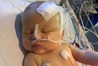 Newborn diagnosed with brain tumour after doctors spot tiny detail on fingernail