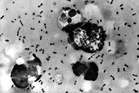 What we know about suspected plague in Russia after lab worker dies