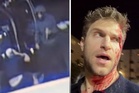 Pretty Little Liars star beaten and robbed outside luxury grocery store in Hollywood
