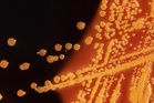 Stanford team uses AI to design custom viruses that destroy resistant E. coli