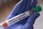 Hantavirus outbreak risk to public ‘absolutely low’: WHO