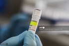 WHO confirms six hantavirus cases on cruise ship