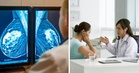 [QUIZ] “What does a mammogram do?” Take This Quiz to Test Your Knowledge About Breast Cancer