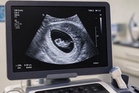 ‘Saya scan ibu mengandung tapi tak jumpa kepala bayi’