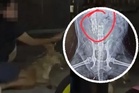 Tiada laporan rasmi sahkan gambar tular X-ray Rocky – Peguam