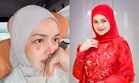 Pipi Siti lebam, peminat risau, doa baik-baik saja