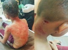 Budak 8 tahun cedera diserang anjing liar di Pantai Kuala Kemasin