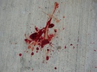 Varsity student under seven-day watch over Sepang stabbing as police record statements from 10 witnesses; victim in ICU