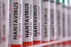 Countries track passengers from virus‑hit cruise ship as Hondius heads to Spain