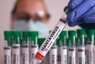 Third Briton has suspected hantavirus after cruise outbreak, says UK health agency