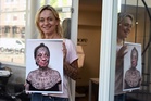 Erasing an abuser’s ink, one painful laser session at a time
