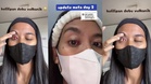 Mata Jadi Merah Selepas Terkena Abu Gunung Berapi Anak Krakatau, Wanita Ini Kongsi Pengalaman