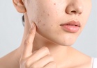 Protecting skin from summer sun and heat