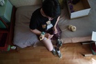 For one Ukrainian war amputee, rebuilding is painful after a Russian strike killed her husband
