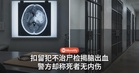 扣留期间送院不治，尸检揭脑部出血！律师团质疑警方「无内伤」说法