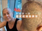 草蜢蔡一傑 證實癌細胞擴散