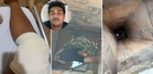 'Bomba, doktor pelik aku boleh selamat' - Lelaki kongsi terperangkap 3 jam dalam longkang 12 meter, lutut terbelah siap ada kulit ular!