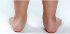 Flat Foot punca tulang belakang derita?